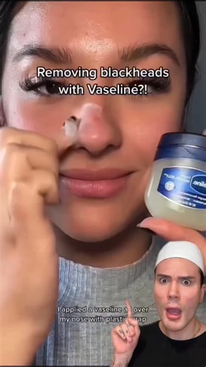 Matt Randon 🧩 on Instagram: "VIRAL BLACKHEAD REMOVAL HACK!😱 @centellian24_global partner. This duo is great for removing back heads and sebaceous filaments!🥰 #blackheads #blackhead #skincarereview #skincarehacks #skincareregimen #skincarethatworks #skincaregoals #acneproneskin #doublecleansing"