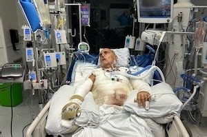 Montreal man sues Ferrari Quebec after life-threatening injuries caused by explosion of Luc Poirier’s car at dealership