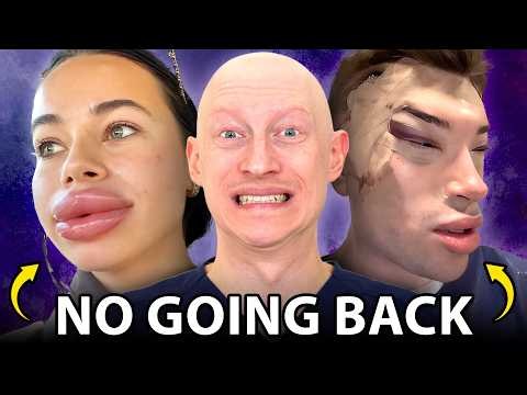 Plastic Surgery Is RUINING Your Face!