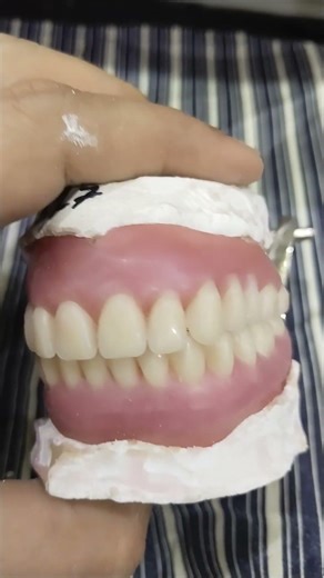 Upper Lower Complete Denture Teeth Arrangement By Haider 😁😁😁#completedenture #dentures #viralvideo