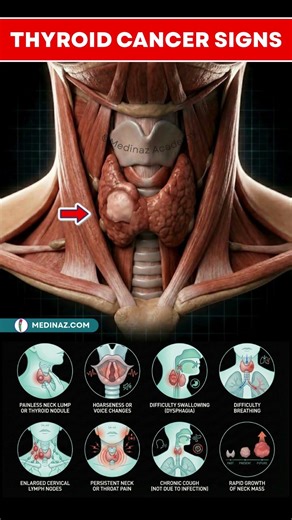 Thyroid Cancer Signs You Should Never Ignore | Thyroid Cancer