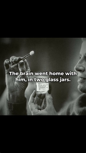 Einstein's brain was never buried. A pathologist took it home