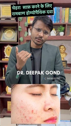 PIMPLES| Face Problems| चेहरा साफ़ करने की होम्योपैथिक दवा|Best Homeopathic Medicine| Dr Deepak Gond