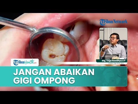 Penting! Bahaya Gigi Ompong Jika Dibiarkan Terlalu Lama bagi Kesehatan Mulut