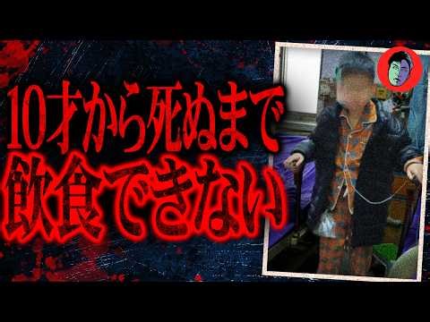 「簡単な手術です」→10才で一生食事が不可能に