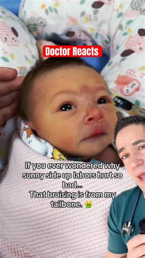 Why you DON’T want to deliver a baby this way