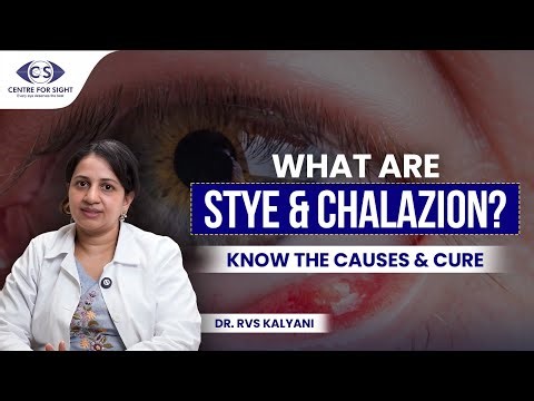 Stye (Hordeolum) Treatment at Home | Dr. RVS Kalyani | Centre For Sight