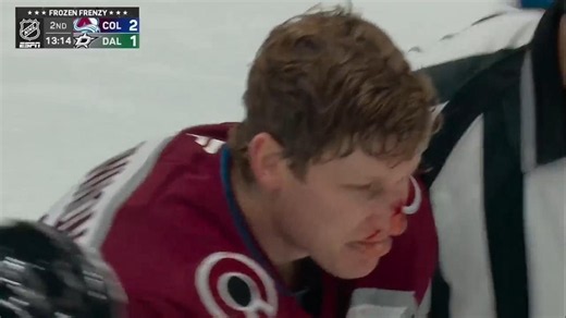 Moment: MacKinnon bloodied after intense fight with Hintz