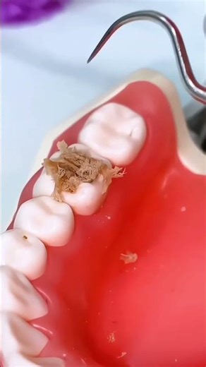 Clean Teeth Anywhere 😱 | Portable Toothpick Cleaner