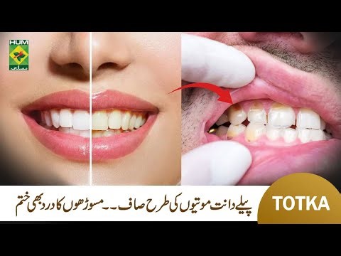 Homemade Teeth Whitening Powder | Hakim Shah Nazir | Kiran Khan | Masala TV