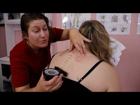 ASMR Chiropractic Back Cracks and Nervoscope Testing for Easy Sleep