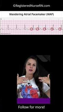 ECG NCLEX Quiz Question & Rationale #nursing #nurse