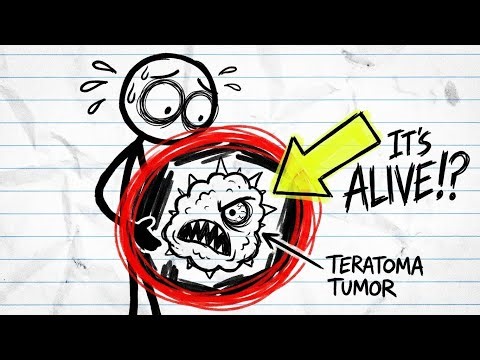 You Have A Monster In Your Stomach Literally