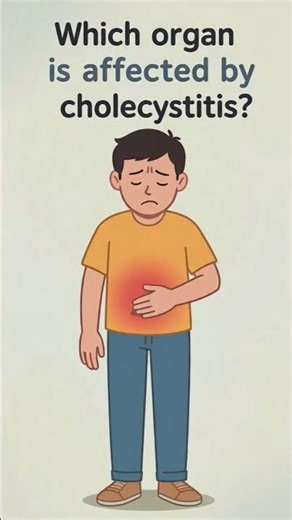 Cholecystitis|| Cholecystitis Pathology|| Cholecystectomy|| #short #shorts #trending