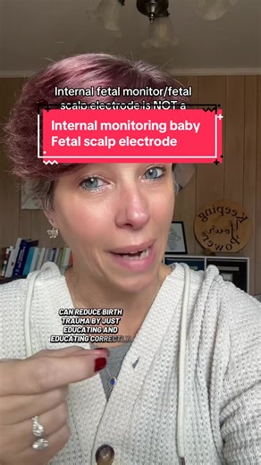 What have you heard the internal fetal monitor called? The fetal scalp electrode can very accurately monitor baby in labor. But it should not be called a sticker or clip by obgyns, nurses or midwives.