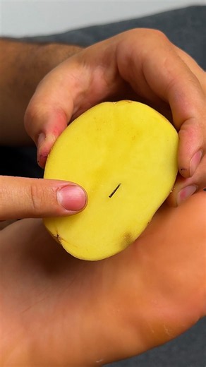 Potato Splinter Removal Trick 🥔✨ #easy #splinterremoval #potato #trick
