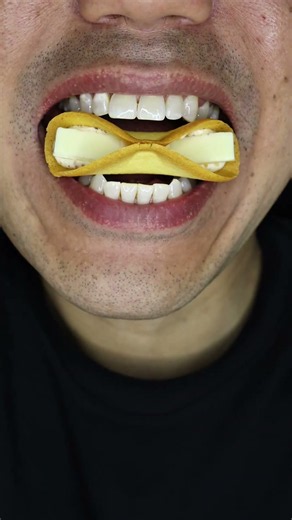 ASMR | NewYork Perfect Cheese… So Satisfying 🧀 #DoctorTristanPeh #ASMR