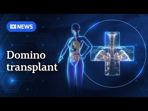 Meet the triple organ transplant recipient from Queensland who defied the odds | ABC NEWS
