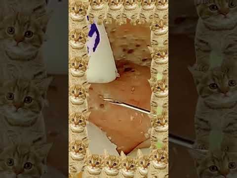 Blackheads Removal #463 | Acne Treatment and Very Satisfying Satisfying Pimple pop #blackheads