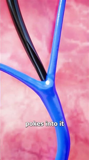 How A Mosquito Needle Works 🤔