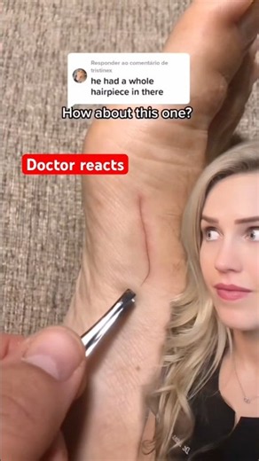 Doctor reacts: what’s under his skin?