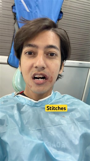 Stitches lag gye muh me😩#familyvlog #minivlog #shorts
