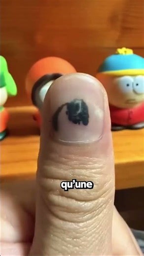 Il A Photographié La Repousse De Son Ongle