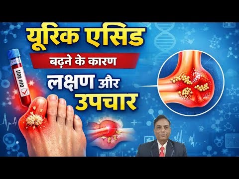 यूरिक एसिड बढ़ने के कारण लक्षण और उपचार । High Uric Acid Causes and Symptoms