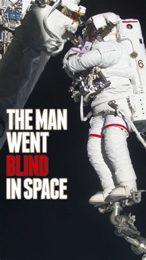 This man went blind in space