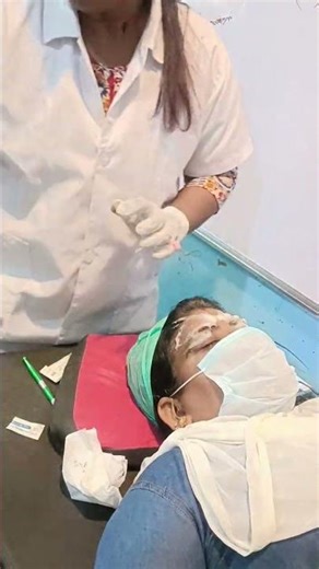 micro needling treatment