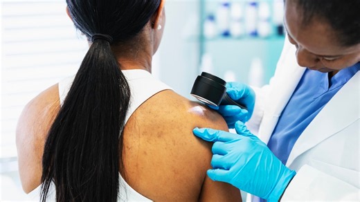 New cancer vaccine could change how doctors fight deadly melanoma, expert says