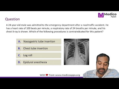 🚨⚠️High-Yield Surgery | NEET PG🩺 Master Diaphragmatic Injuries in 7 Minutes! | |Dr. Soumya Banerjee