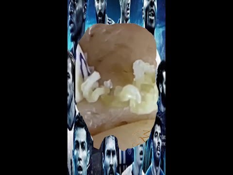 Blackheads Removal | Acne Treatment and Very Satisfying Satisfying Pimple pop #blackheads