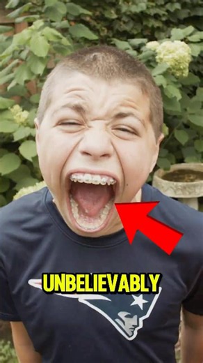 He Has the Biggest Mouth in the World! 😱