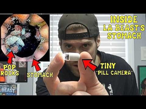 A Visual Look Inside L.A. Beast's STOMACH (Using A Camera Pill) | After Eating Pop Rocks & Coca Cola