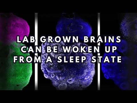 Lab Grown Mini Brains Can Be Woken Up From Sleep-Like States 