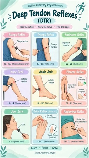 Deep Tendon Reflexes (DTR) Made Easy | All Reflexes in 1 Chart | Physio Exam