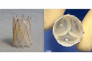 Heart valve developed at UC Irvine shines in early-stage preclinical testing