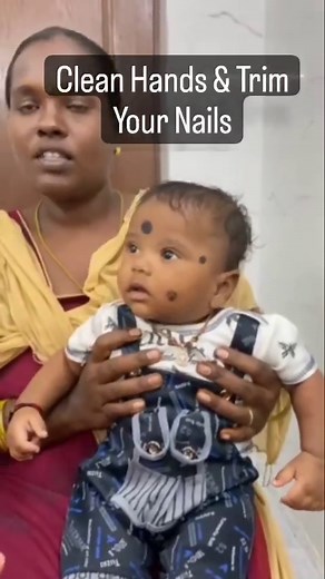 Dr Sumanth Pasunuti on Instagram: "No More Watery Eyes: Quick and Effective Tear Duct Massage Thanks to Dr Soujanya gona Prabhat eye hospital Jaggayyapet Andhra Pradesh Tears are made in the tear glands, also called lacrimal glands, located above the eyeball under the bone Tears flow from the lacrimal gland into the eye through little tubes in the eyelid. Each time you blink, tears wash the eye and then flow towards the nose. They drain into 2 tiny holes (puncta) on the inside corner of each eye