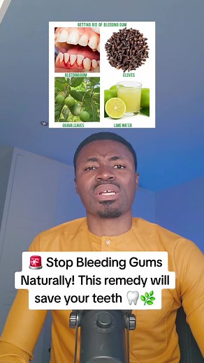 Stop Bleeding Gums Naturally with Herbal Remedies