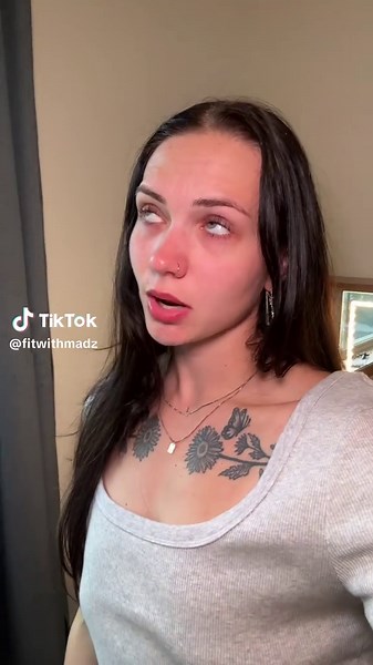 Breast Augmentation Journey: Boosting Confidence After Weight Loss