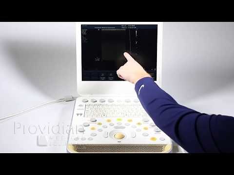 Philips CX50 Training Part 1: System Overview