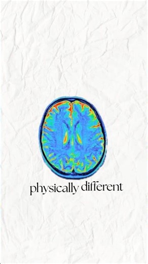 brain is physically... #shorts #neuroplasticity #science #sciencefacts #neuroscience