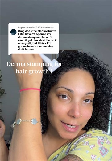 Derma Stamping for Hair Growth: What You Need to Know