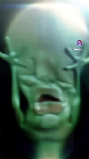 Me looking into my neighbours window when I was a kid