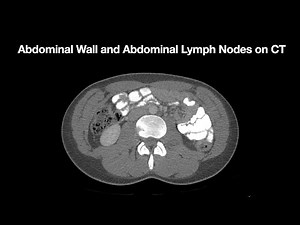 Anatomy of the Abdominal Wall and Abdominal Lymph Node Stations