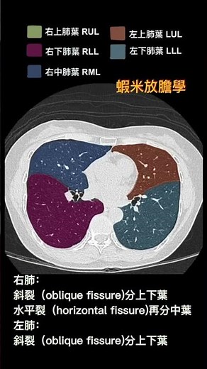電腦斷層左右肺葉解剖｜chest CT anatomy