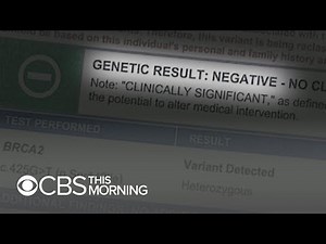 BRCA gene test questioned after unnecessary surgeries
