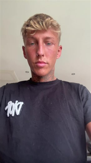 Understanding Excessive Sweating at the Gym