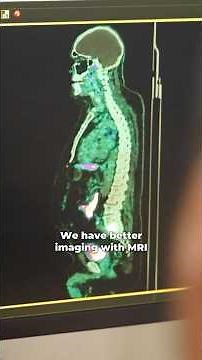 Exercise Medicine for Prostate Cancer Patients Undergoing Hormone Therapy